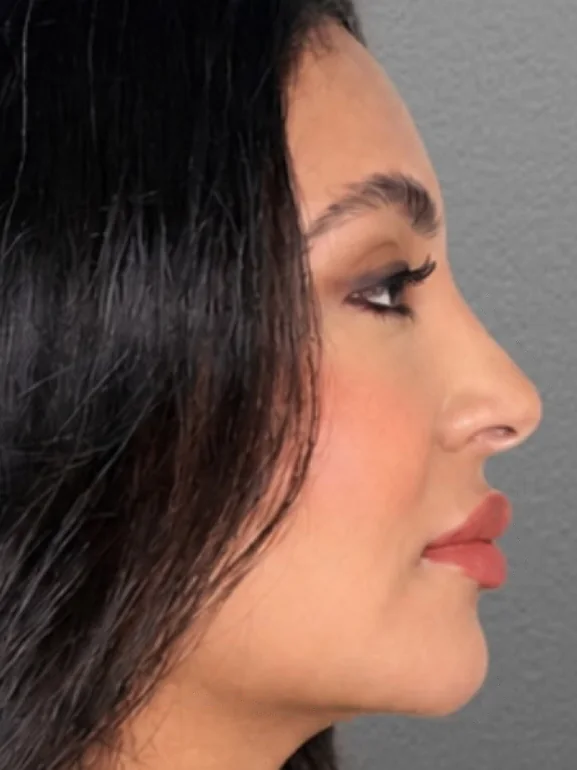 Perfil da Dra. Alexia Rezende, com o contorno do rosto sendo desenhado em pontilhado